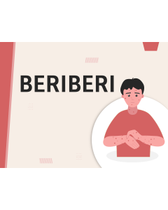 Template PowerPoint dan Google Slide Beri-beri